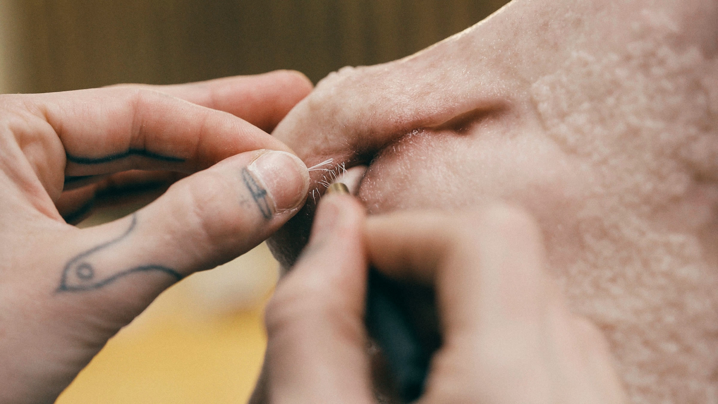 Hands sewing the skin